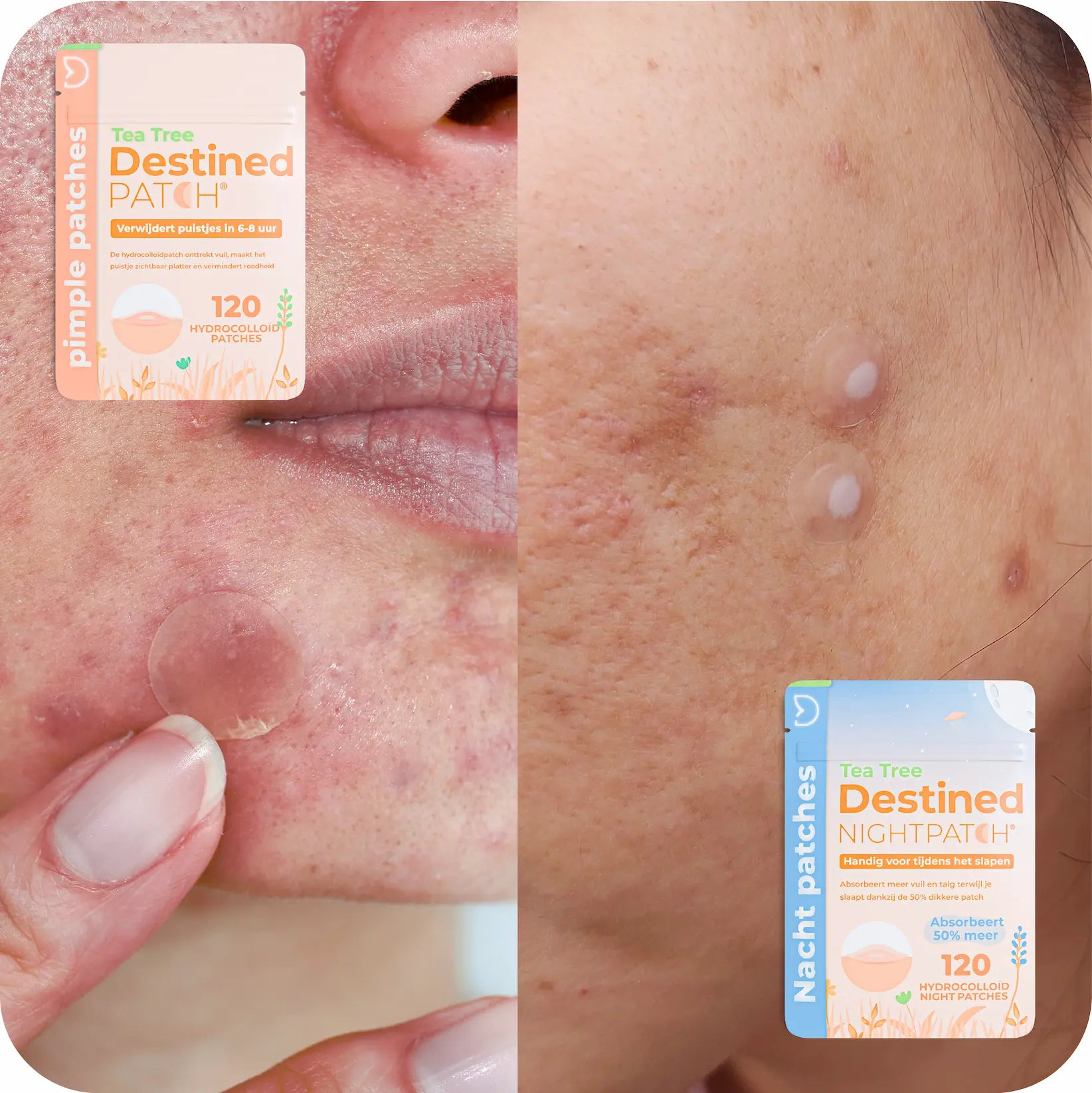 Destined Patch® Duo-Pack