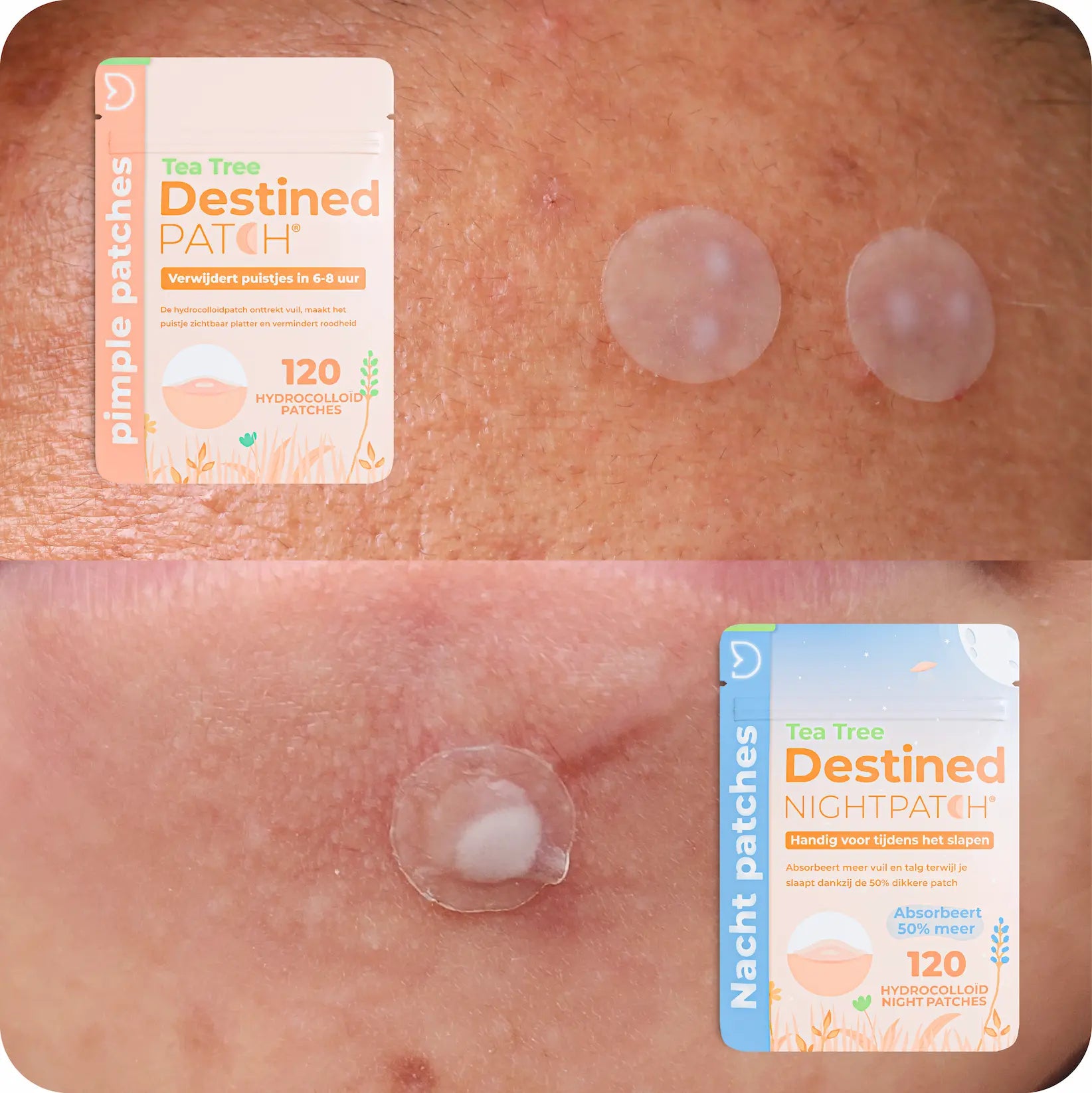 Destined Patch® Duo-Pack
