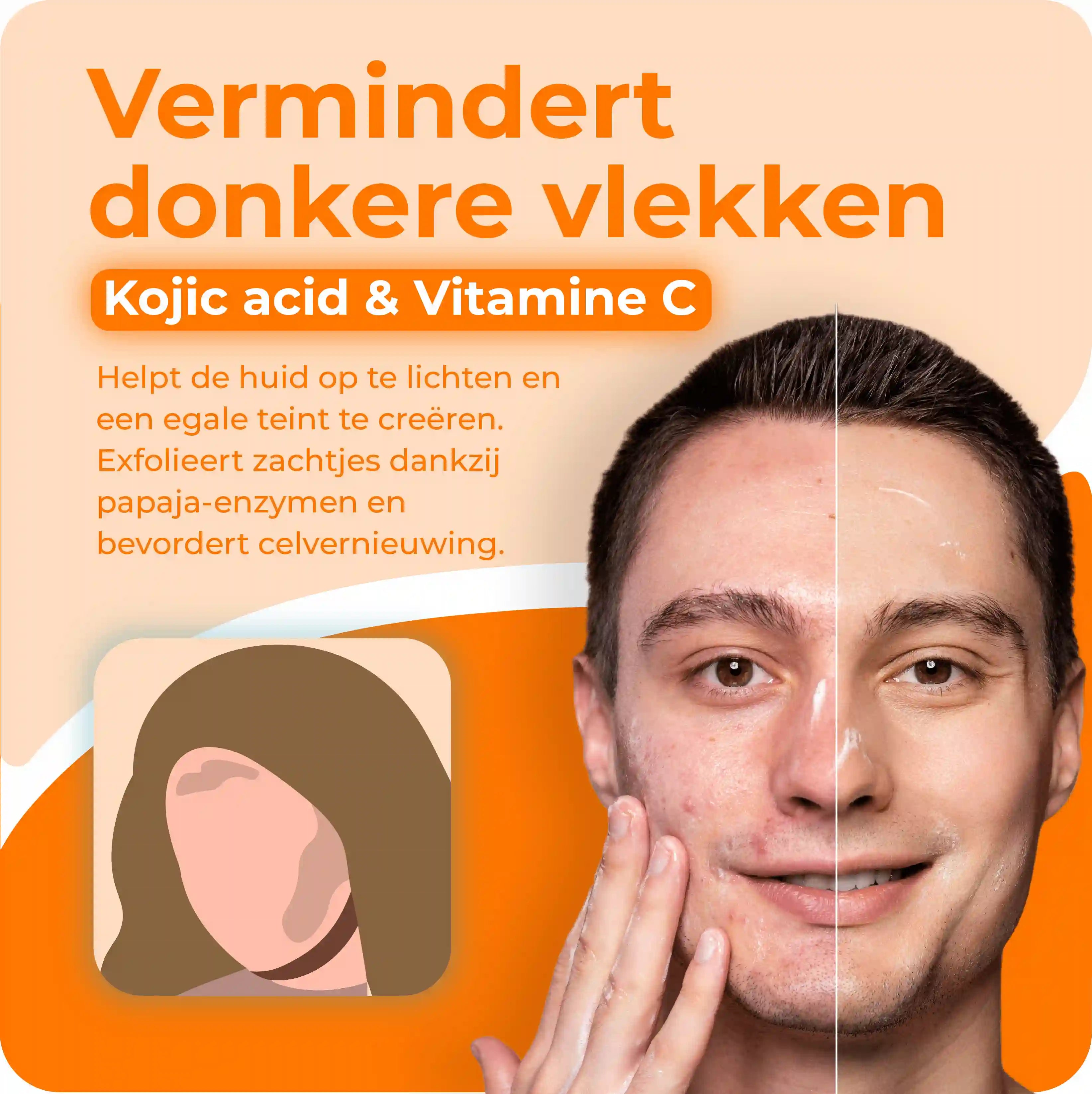 Papaya Kojic Acid | Hyperpigmentatie