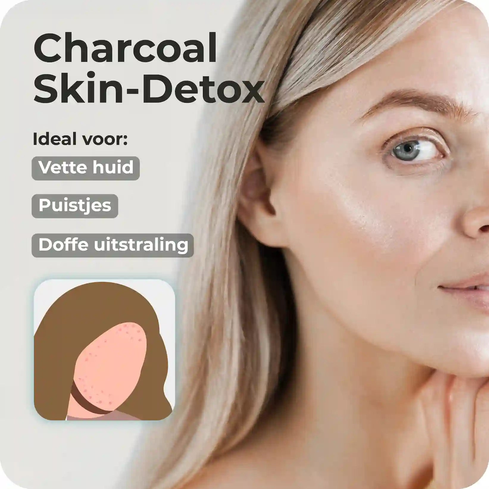 Charcoal Zeep | Vette huid