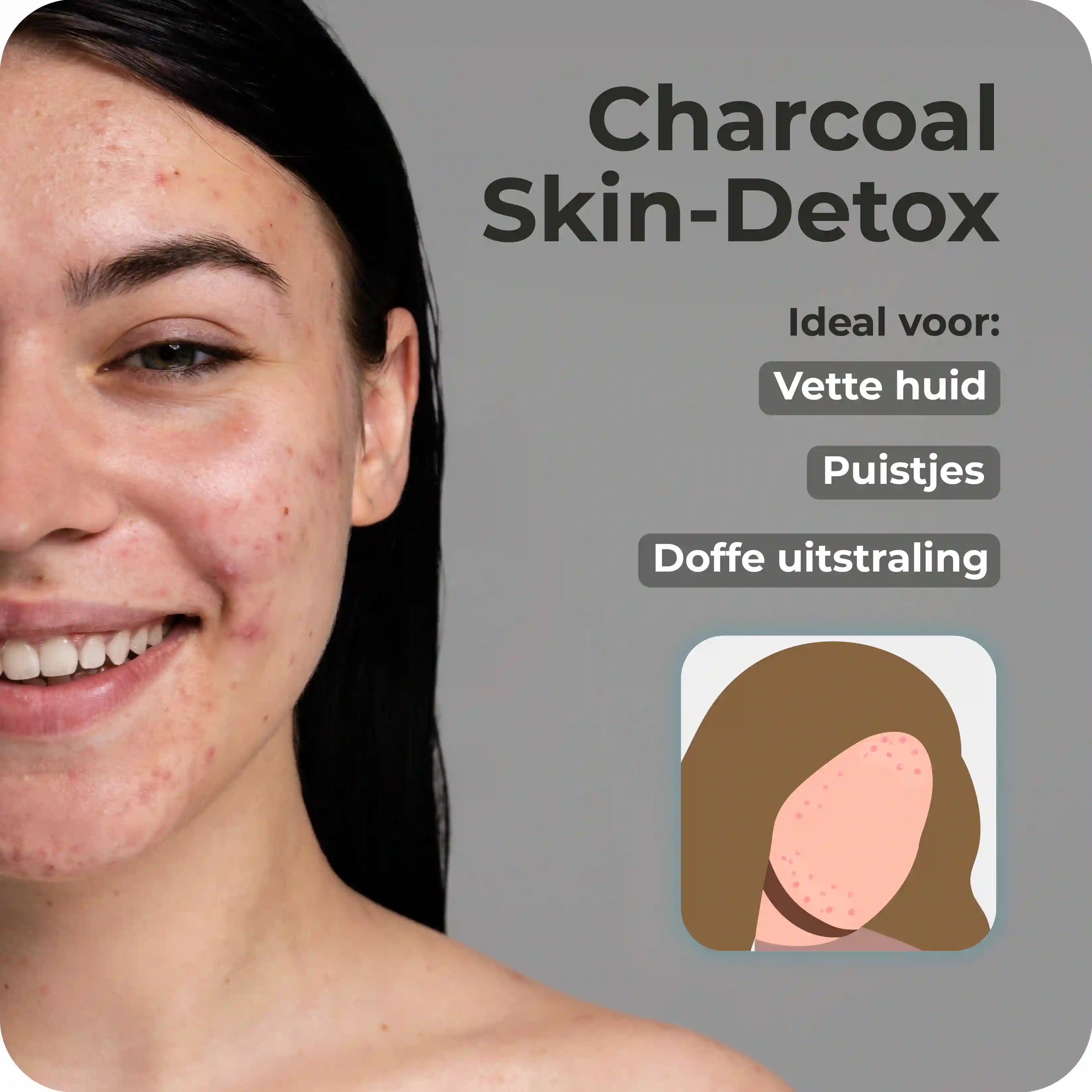 Charcoal Zeep | Vette huid