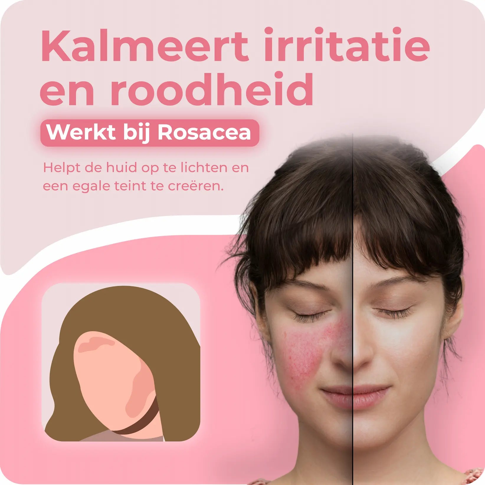 Rozen zeep | Geïrriteerde huid