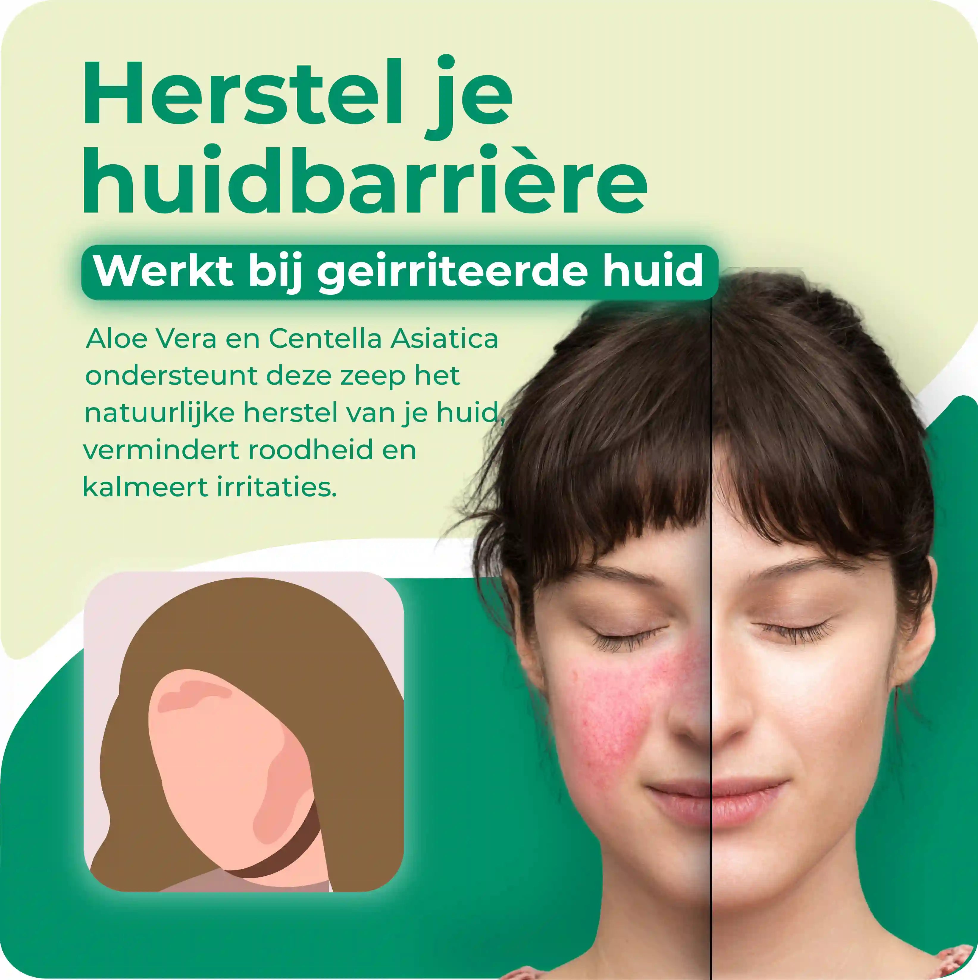 Aloë vera Zeep | Branderige huid
