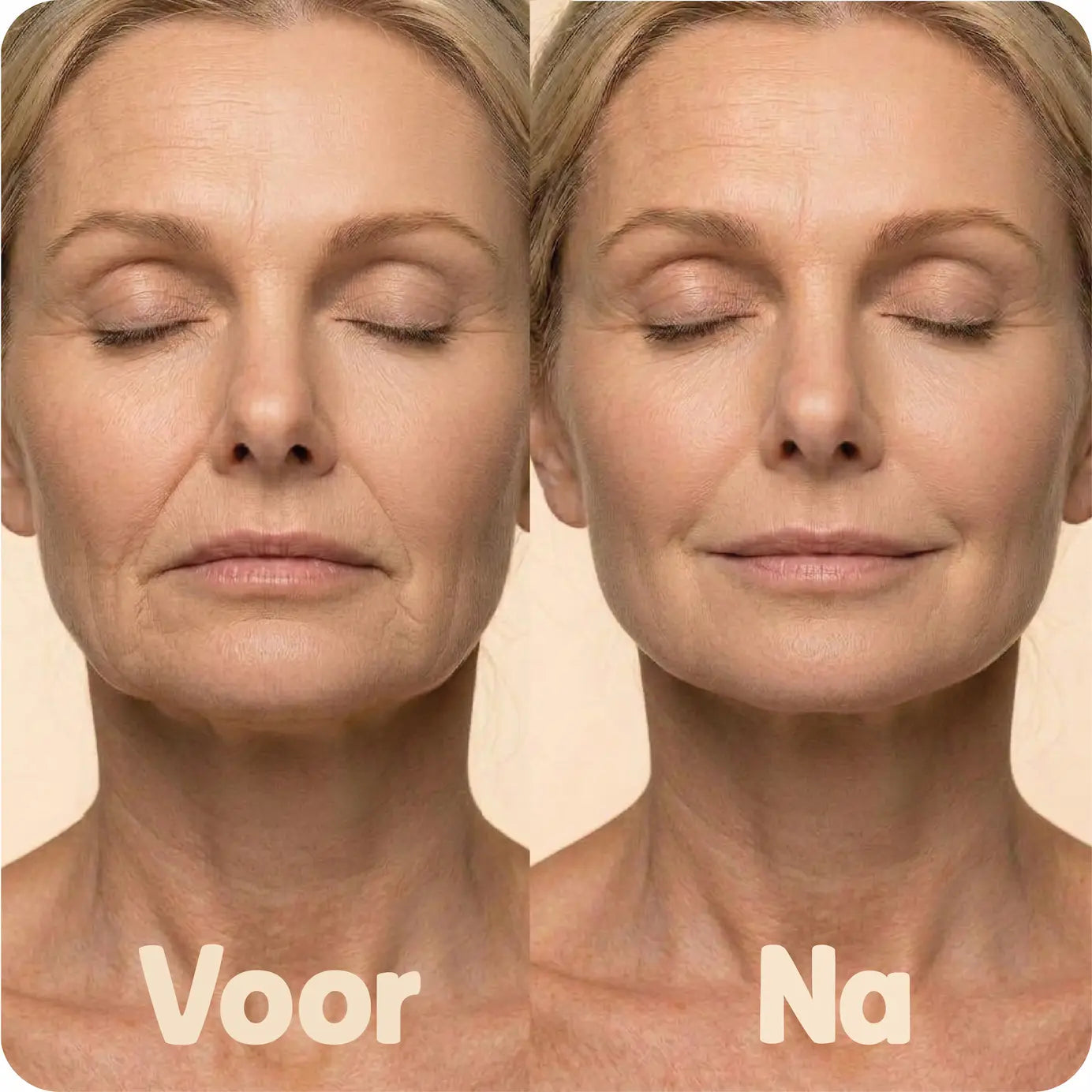 Facelift Tape Generation 3.0