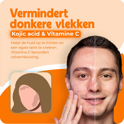 Kojic Acid zeep | Vitamine C Brightening Bar